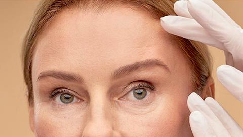 Brow Lift - Ανόρθωση Μετώπου & Φρυδιών